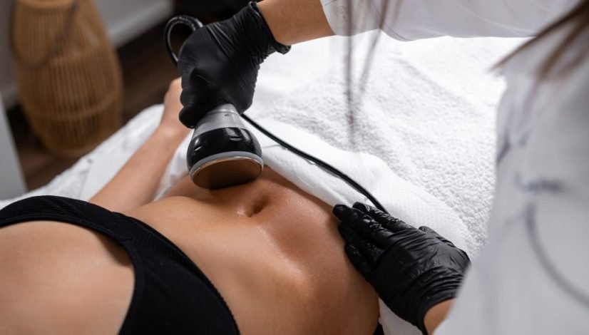 Body Contouring treatment