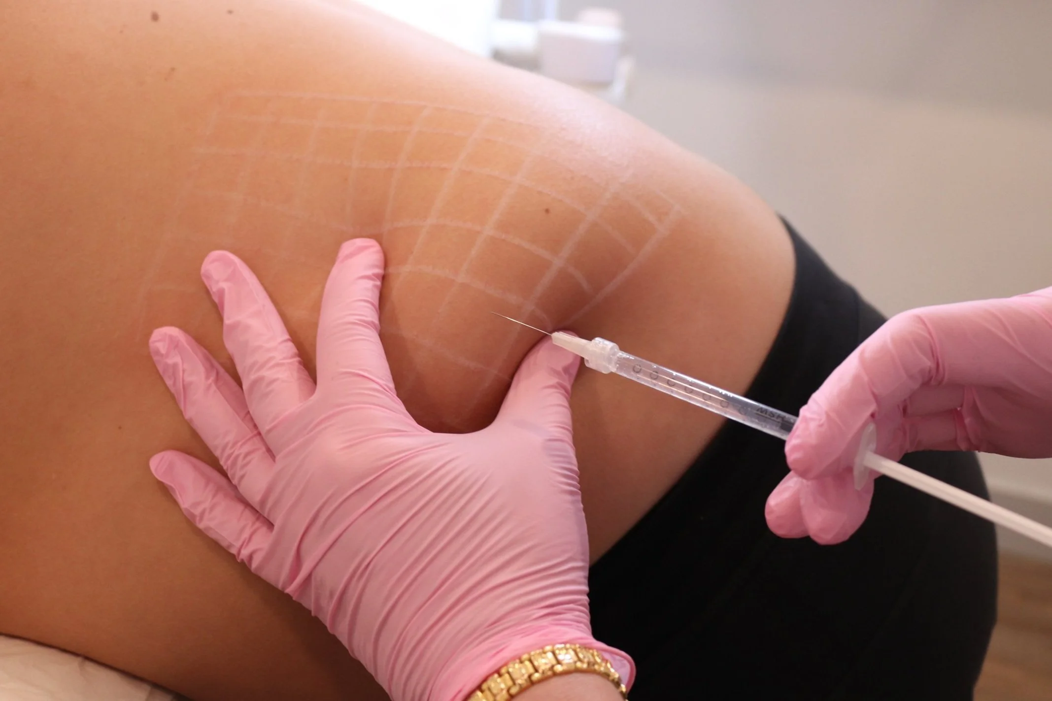 Weight Management Injections